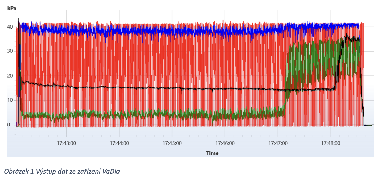 Achillova pata dojírny - Mléčný audit-graf